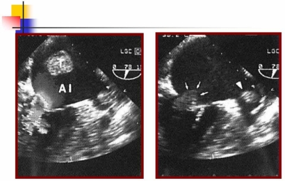 Fig. (4)