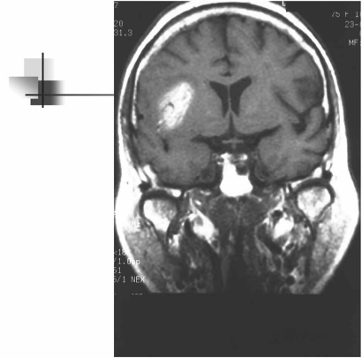 Fig. (2)