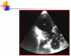Fig. (3)