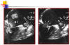 Fig. (4)