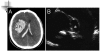 Fig. (5)