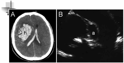 Fig. (5)