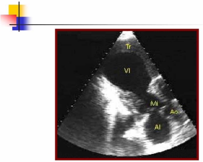 Fig. (3)