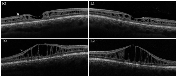 Figure 2.