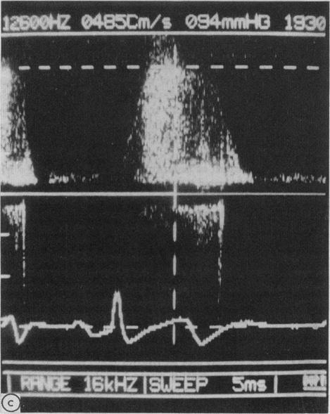 Fig c