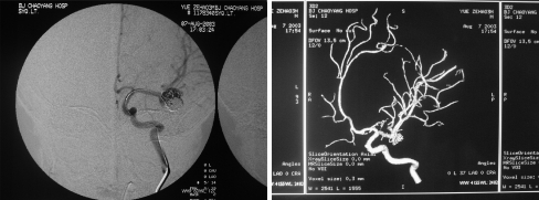 Fig. 6