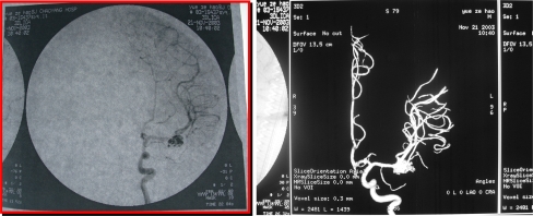 Fig. 7