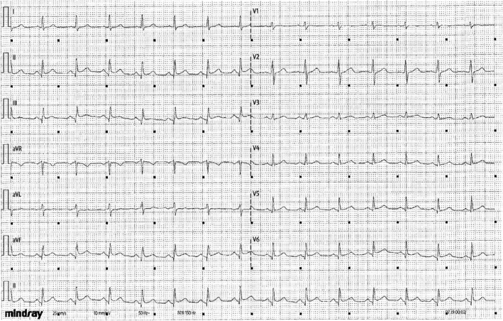 FIGURE 1