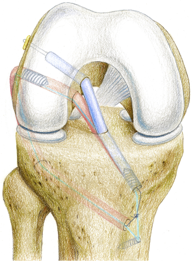 Fig 5