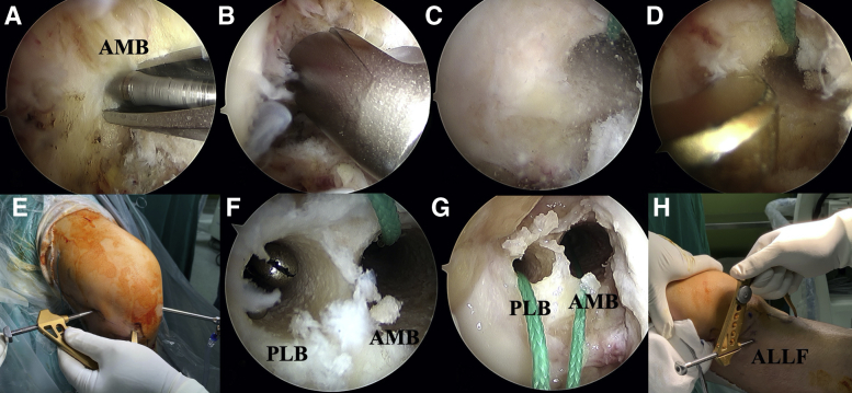 Fig 3