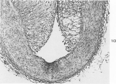 Fig. 10