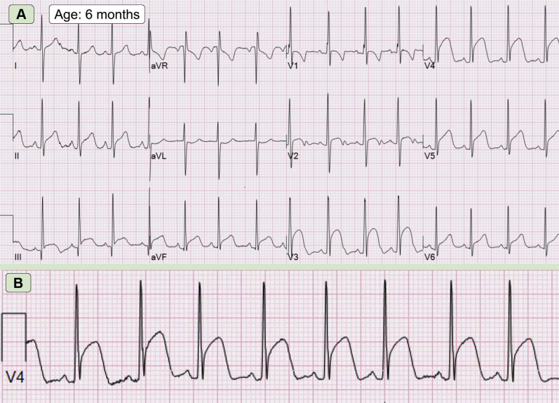 Figure 3