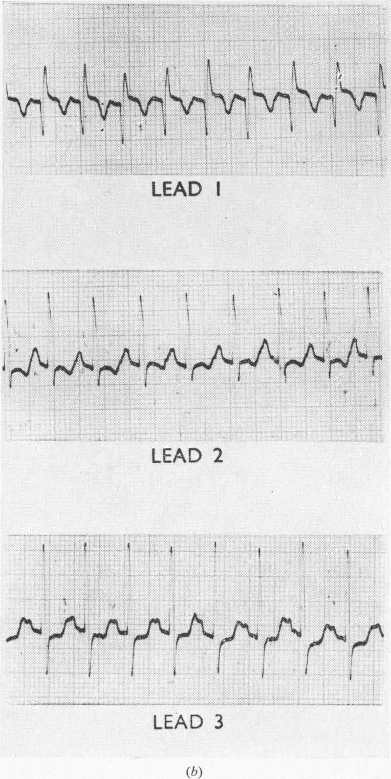 Fig. 3b