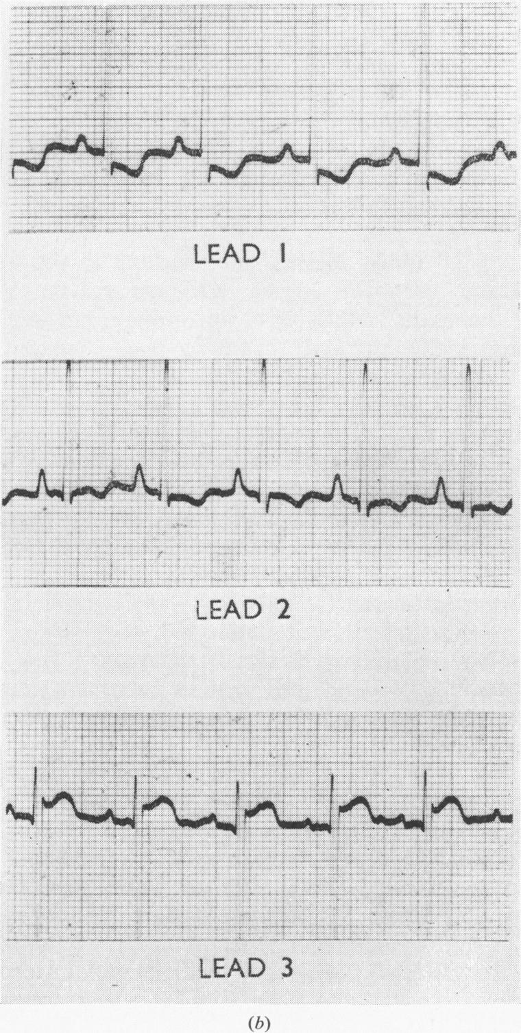 Fig. 1b