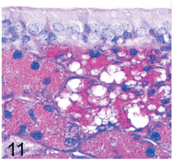 Fig. 11