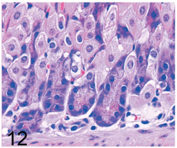 Fig. 12