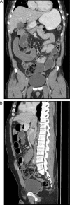 Fig. 2