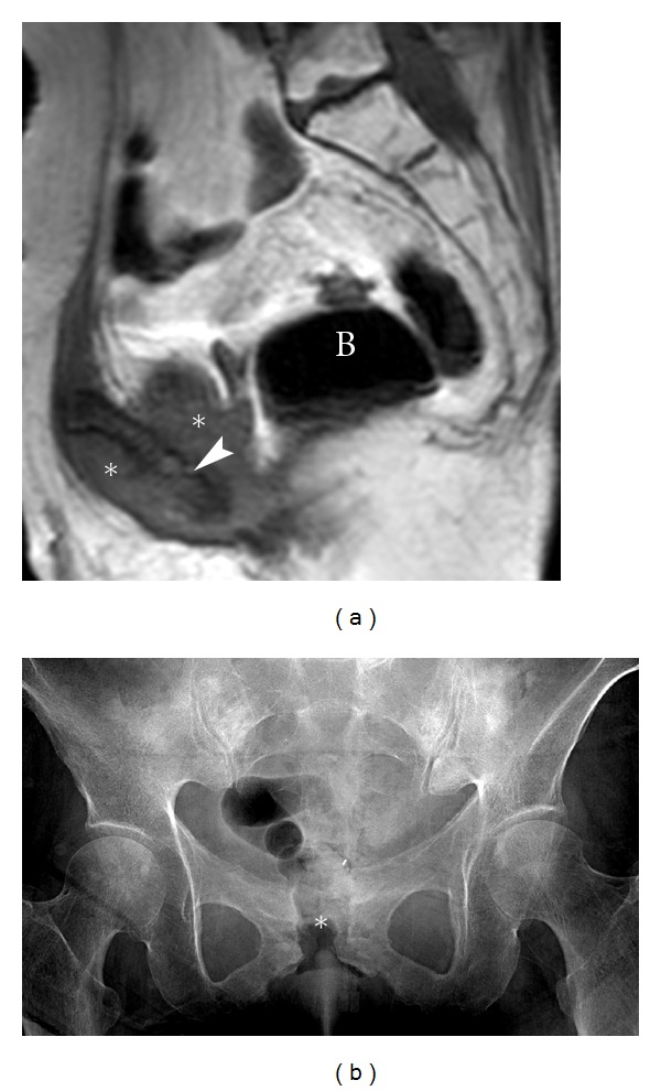 Figure 12