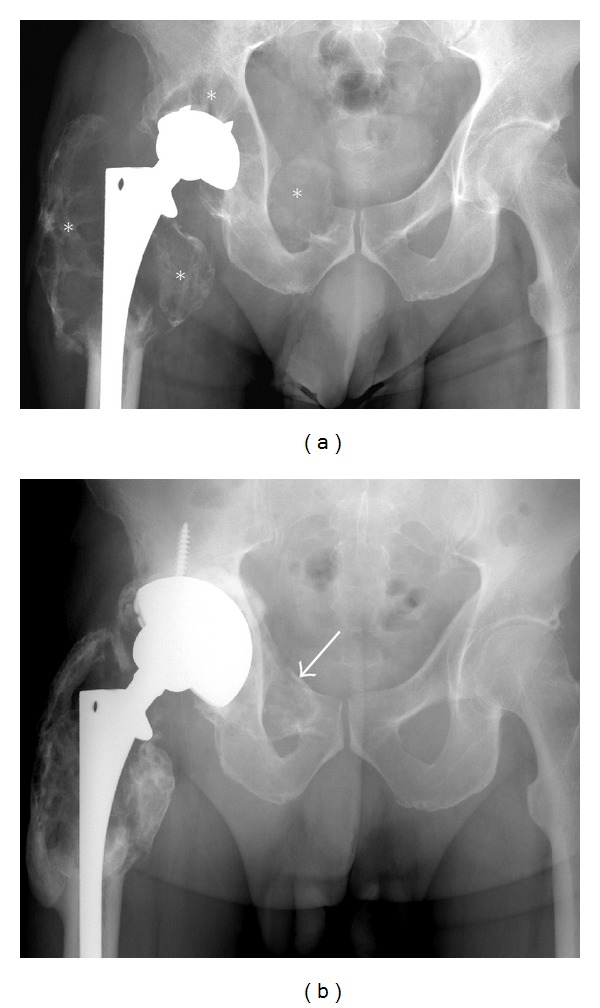 Figure 14