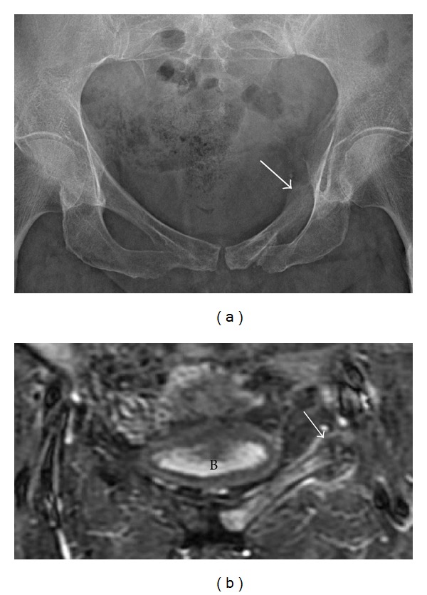 Figure 13