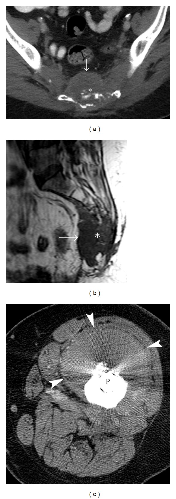 Figure 9