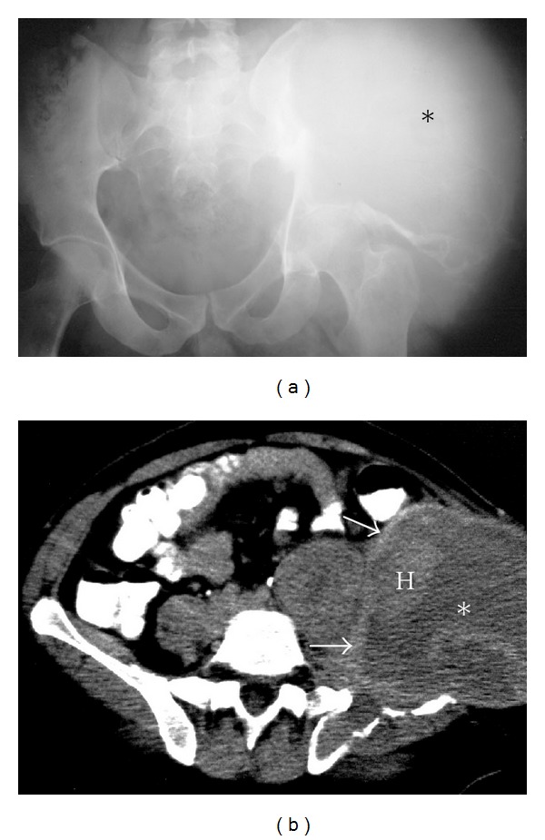 Figure 11