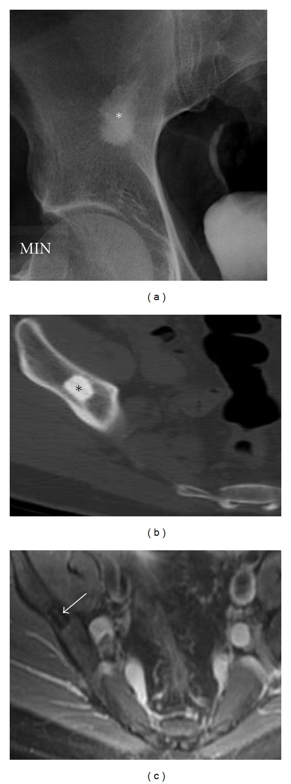 Figure 16