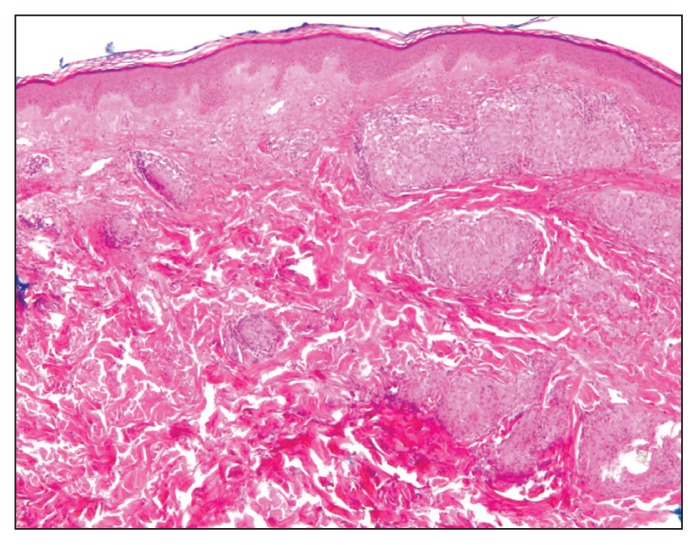 Figure 2: