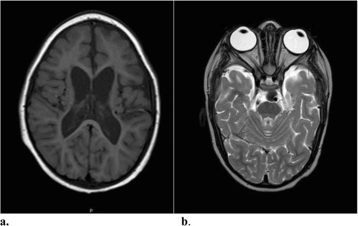 Fig. 5