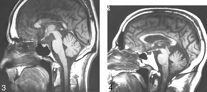 fig 3.