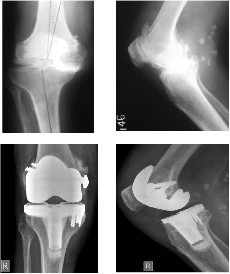 Fig. 1