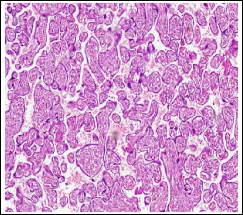 Fig.1C