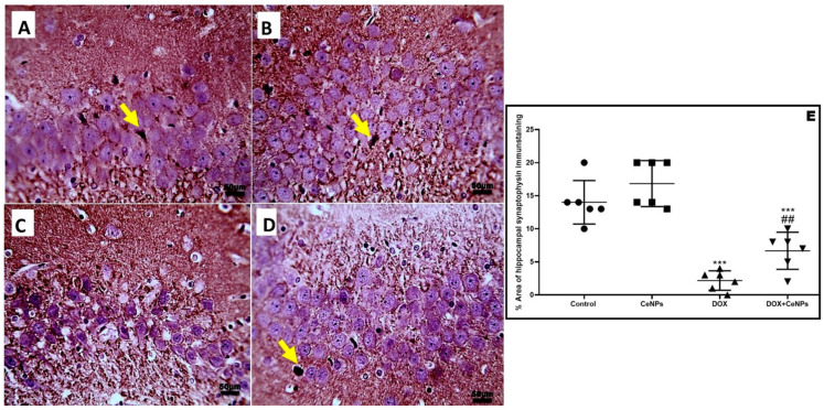 Figure 11