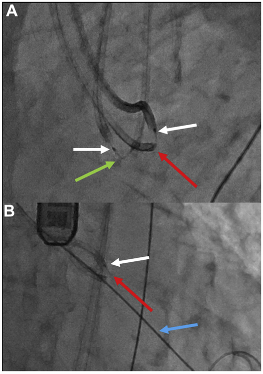 FIGURE 11