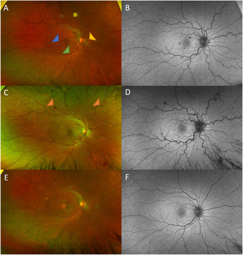 Fig. 2