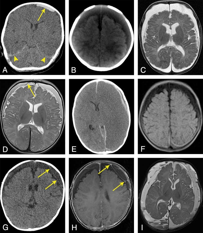 Fig 1.