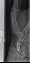 Fig. 11