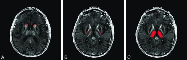 Fig 1.