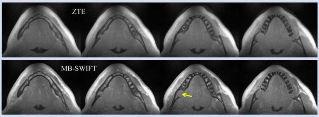 Fig. 10