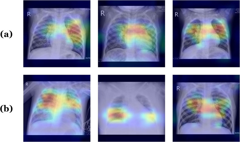 Fig. 12