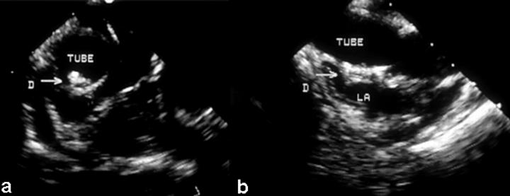 Figure 16  