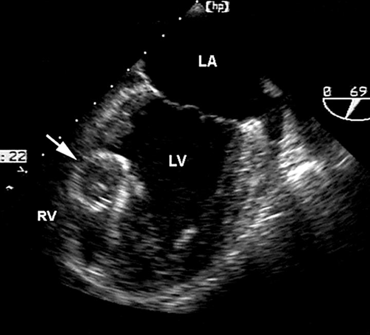 Figure 15  