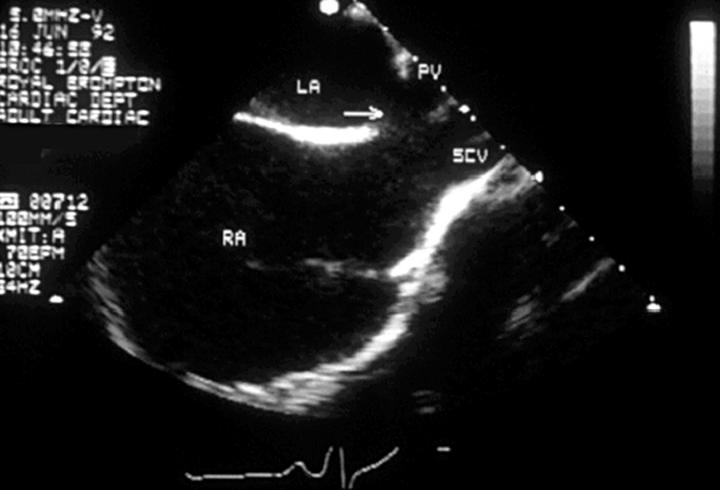 Figure 3  