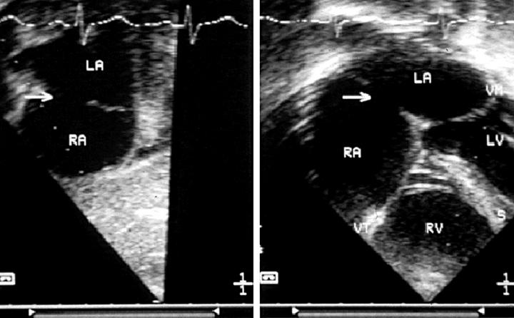 Figure 1  