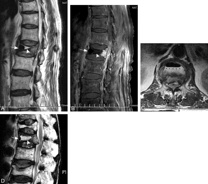 Fig 4.