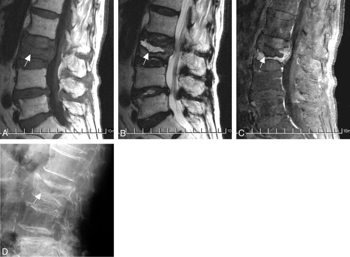 Fig 3.