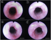 Fig. 2
