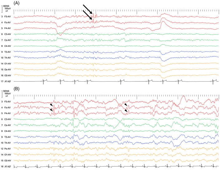 FIGURE 4