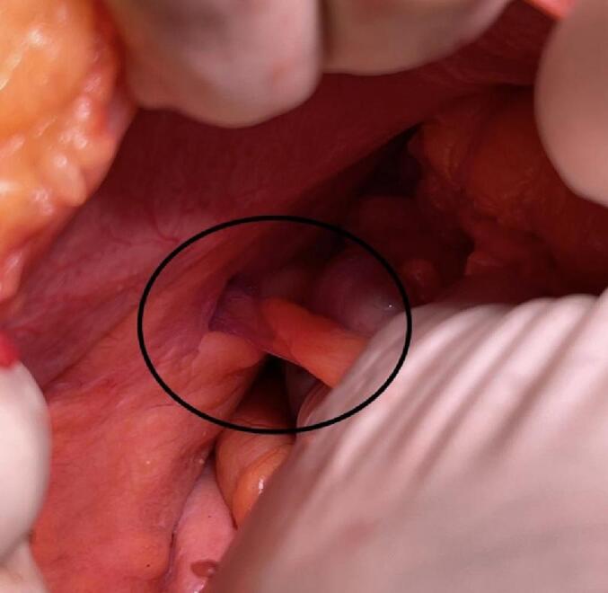 Fig. 2