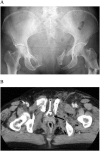 Fig. 1